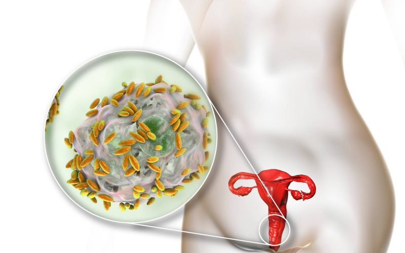 Understanding Bacterial Vaginosis: Prevention and Awareness