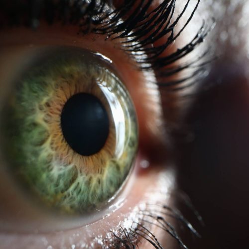 Understanding Iridology: A Fascinating Approach to Holistic Health